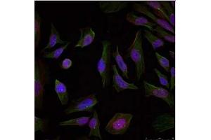 Image no. 1 for anti-Progesterone Receptor (PGR) (Ser190) antibody (ABIN319297) (Progesterone Receptor anticorps  (Ser190))