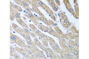 Immunohistochemistry of paraffin-embedded Human liver using FUT6 Polyclonal Antibody at dilution of 1:100 (40x lens). (FUT6 anticorps)