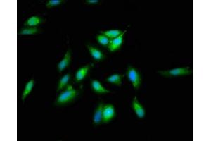 Immunofluorescence staining of Hela cells with ABIN7170782 at 1:66, counter-stained with DAPI. (SREBF2 anticorps  (AA 75-164))