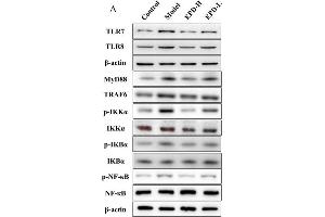 EPD suppressed the activation of the Toll-like receptor 7-myeloid differentiation primary response gene 88-nuclear factor-κB (TLR7/8-MyD88-NF-κB) signaling pathways. (NFKBIA anticorps  (AA 1-120))