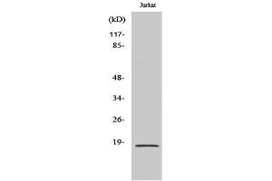 Western Blotting (WB) image for anti-Superoxide Dismutase 1, Soluble (SOD1) antibody (ABIN5958576) (SOD1 anticorps)