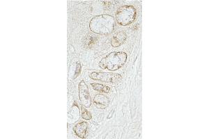 Immunohistochemistry (IHC) image for anti-Torsin A Interacting Protein 1 (TOR1AIP1) (AA 275-325) antibody (ABIN7448627)