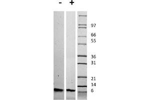 SDS-PAGE of Human Insulin-like Growth Factor I Recombinant Protein SDS-PAGE of Human Insulin-like Growth Factor I Recombinant Protein.