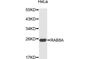 Western blot analysis of extracts of HeLa cells, using RAB8A antibody. (RAB8A anticorps)