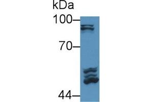 Detection of POSTN in Rat Serum using Polyclonal Antibody to Periostin (POSTN) (Periostin anticorps  (AA 24-173))