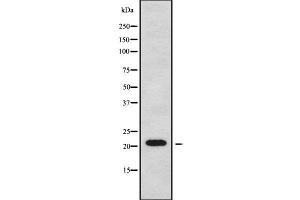 Western blot analysis of CTAG2 using MCF7 whole cell lysates