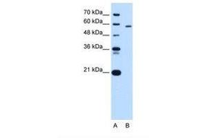 Image no. 2 for anti-Pyruvate Kinase, Liver and RBC (PKLR) (AA 56-105) antibody (ABIN320669) (PKLR anticorps  (AA 56-105))