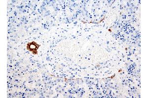 Immunohistochemistry (IHC) image for anti-Keratin 7/17/19 (KRT7/17/19) antibody (ABIN108432) (Keratin 7/17/19 anticorps)