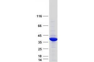 Validation with Western Blot