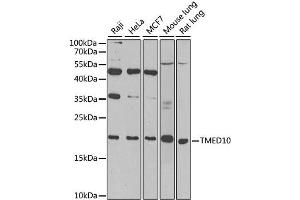 Western blot analysis of extracts of various cell lines, using TMED10 antibody. (TMED10 anticorps)