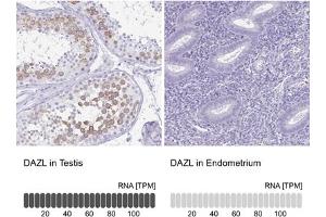 Immunohistochemical staining (Formalin-fixed paraffin-embedded sections) of human testis and endometrium tissues. (DAZL anticorps  (AA 169-231))