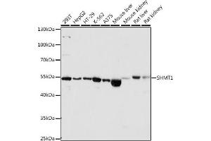 Western blot analysis of extracts of Mouse liver, using SHMT1 antibody (ABIN6132654, ABIN6147744, ABIN6147746 and ABIN6216135) at 1:1560 dilution. (SHMT1 anticorps  (AA 285-444))