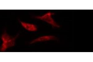 anti-G Protein-Coupled Receptor 34 (GPR34) (C-Term) antibody