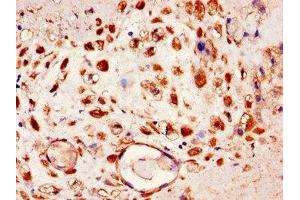 Immunohistochemistry of paraffin-embedded human placenta tissue using ABIN7151436 at dilution of 1:100