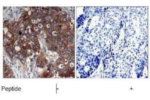 Image no. 1 for anti-Receptor tyrosine-protein kinase erbB-2 (ErbB2/Her2) (Tyr877) antibody (ABIN197222)