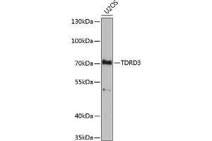 Western blot analysis of extracts of U2OS cells, using TDRD3 antibody (ABIN6133097, ABIN6148978, ABIN6148979 and ABIN6221657) at 1:1000 dilution. (TDRD3 anticorps  (AA 1-220))