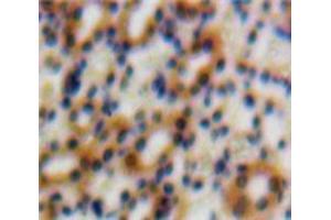 IHC-P analysis of Kidney tissue, with DAB staining. (TGFB1I1 anticorps  (AA 252-390))