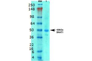 Western Blot analysis of Rat brain membrane lysate showing detection of SLC38A1 protein using Mouse Anti-SLC38A1 Monoclonal Antibody, Clone S104-32 .