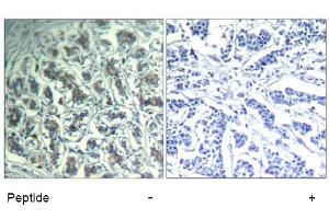 Image no. 1 for anti-phospholipase C, gamma 1 (PLCG1) (Tyr771) antibody (ABIN319399) (Phospholipase C gamma 1 anticorps  (Tyr771))