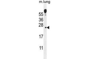 Western Blotting (WB) image for anti-Vesicular, Overexpressed in Cancer, Prosurvival Protein 1 (VOPP1) antibody (ABIN2996076) (VOPP1 anticorps)