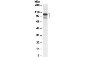 Western blot testing of MOLT4 lysate with SATB1 antibody at 0. (SATB1 anticorps)
