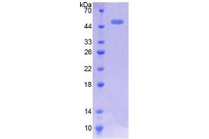 SDS-PAGE analysis of Mouse CACNa1H Protein.