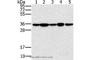 Western blot analysis of Jurkat, 293T and hela cell, mouse brain tissue and K562 cell, using PPP1CC Polyclonal Antibody at dilution of 1:200 (PPP1CC anticorps)