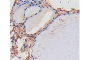 IHC-P analysis of thyroid tissue, with DAB staining. (LRP1B anticorps  (AA 31-194))
