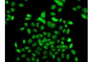 Immunofluorescence analysis of A549 cell using FBXO7 antibody. (FBXO7 anticorps)