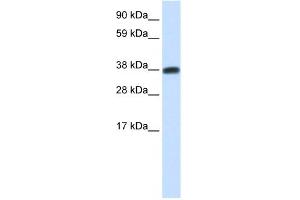 WB Suggested Anti-DMRTC2 Antibody Titration:  0. (DMRTC2 anticorps  (N-Term))