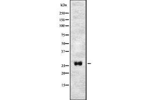 Western blot analysis of T106C expression in HEK293 cells ,The lane on the left is treated with the antigen-specific peptide. (TMEM106C anticorps  (Internal Region))
