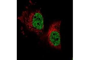 Immunofluorescent staining of human cell line U-251 MG with PARPBP polyclonal antibody  at 1-4 ug/mL dilution shows positivity in nucleus but not nucleoli. (PARPBP anticorps)