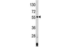 Western blot analysis of ANGPTL3 antibody and mouse liver tissue lysate. (ANGPTL3 anticorps  (AA 82-114))