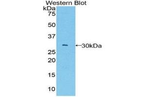 Western Blotting (WB) image for anti-B-Cell CLL/lymphoma 3 (BCL3) (AA 127-376) antibody (ABIN1858125) (BCL3 anticorps  (AA 127-376))