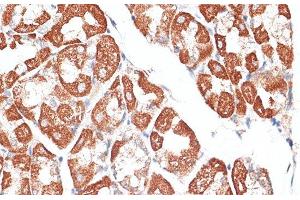 Immunohistochemistry of paraffin-embedded Human stomach using KIF2C Polyclonal Antibody at dilution of 1:100 (40x lens). (KIF2C anticorps)
