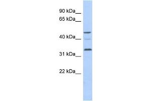 WB Suggested Anti-CCNYL1 Antibody Titration: 0. (CCNYL1 anticorps  (N-Term))