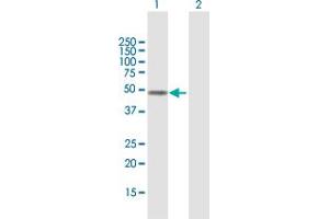 Western Blot analysis of FOXD4L1 expression in transfected 293T cell line by FOXD4L1 MaxPab polyclonal antibody. (FOXD4L1 anticorps  (AA 1-408))