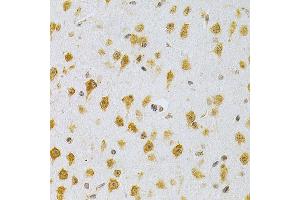 Immunohistochemistry of paraffin-embedded mouse brain using MDM2 Antibody  at dilution of 1:200 (40x lens).