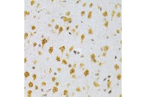 Immunohistochemistry of paraffin-embedded mouse brain using MDM2 Antibody  at dilution of 1:200 (40x lens). (MDM2 anticorps  (AA 130-230))