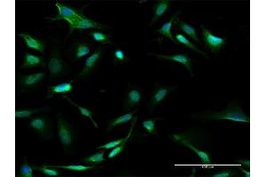 Immunofluorescence of purified MaxPab antibody to GALT on HeLa cell. (GALT anticorps  (AA 1-379))