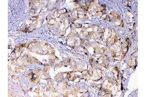 IHC analysis of Adenylosuccinate Lyase using anti-Adenylosuccinate Lyase antibody . (ASL anticorps)