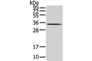 Western Blot analysis of Mouse liver tissue using UCP2 Polyclonal Antibody at dilution of 1/200 (UCP2 anticorps)