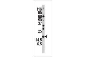 Western blot analysis of anti-Alpha-synuclein Pab (ABIN390368 and ABIN2840773) in mouse brain tissue lysate.