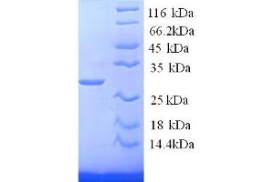 SDS-PAGE (SDS) image for Tryptase alpha/beta 1 (TPSAB1) (AA 35-267), (partial) protein (His tag) (ABIN5713904)