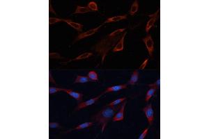 Immunofluorescence analysis of NIH/3T3 cells using Src antibody (ABIN6132240, ABIN6148428, ABIN6148429 and ABIN6215399) at dilution of 1:100. (Src anticorps  (AA 1-80))