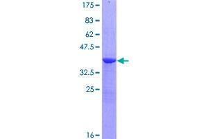 Image no. 1 for Nephronophthisis 1 (Juvenile) (NPHP1) (AA 1-121) protein (GST tag) (ABIN1312861)