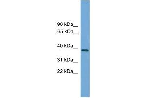 WB Suggested Anti-C22orf36  Antibody Titration: 0. (LRRC75B/FAM211B anticorps  (Middle Region))
