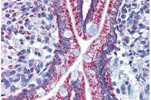 anti-Acetyl-CoA Acyltransferase 2 (ACAA2) (AA 151-261) antibody