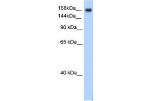 Western Blotting (WB) image for anti-Sodium Channel, Voltage-Gated, Type V, alpha Subunit (SCN5A) antibody (ABIN2461170) (SCN5A anticorps)
