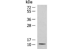 Western blot analysis of Mouse kidney tissue lysate using PCBD1 Polyclonal Antibody at dilution of 1:800 (PCBD1 anticorps)
